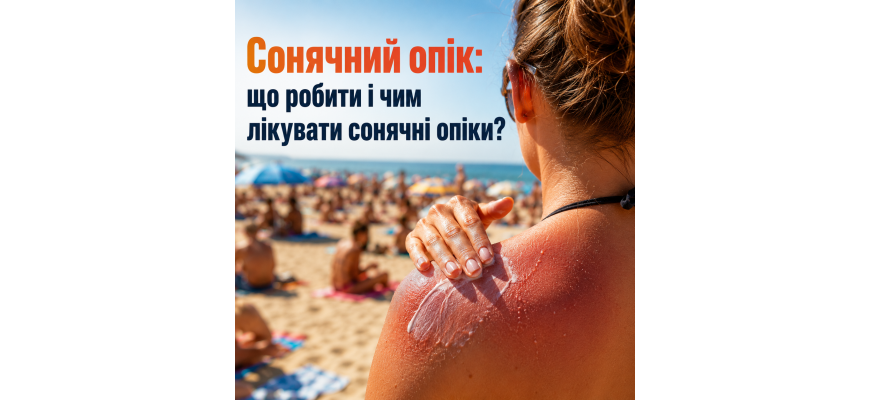 Солнечный ожог: что делать и чем лечить солнечные ожоги?