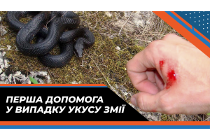Первая помощь в случае укуса змеи