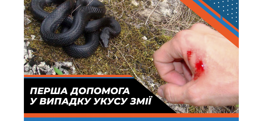 Перша допомога у випадку укусу змії