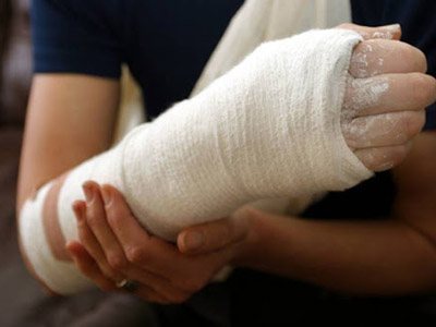 Перша допомога при переломах