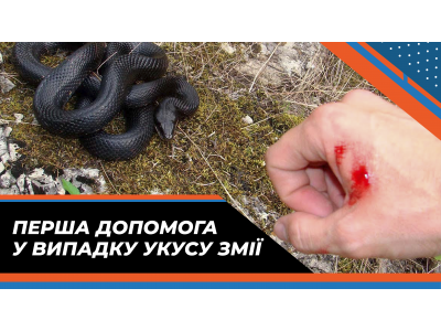 Перша допомога у випадку укусу змії